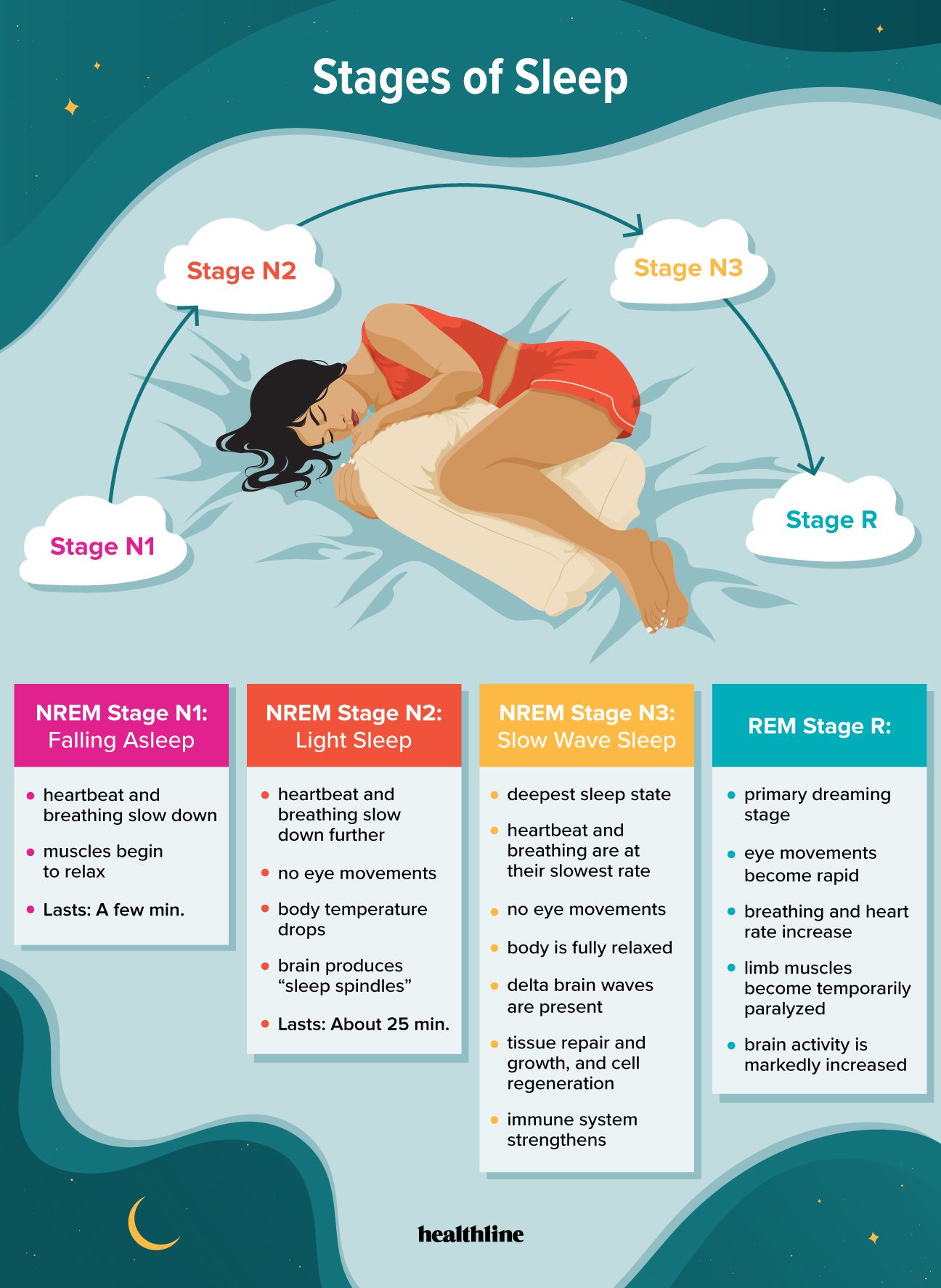 Stages of sleep are N1, N2, N3, and stage R.